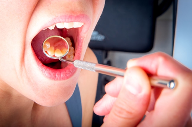 歯ぐきの腫れや出血はありませんか？